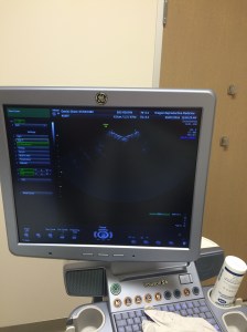 Our ultrasound machine